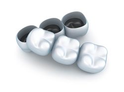 Pontes Dentárias