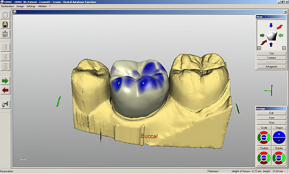 Scan 3D CAD CAM